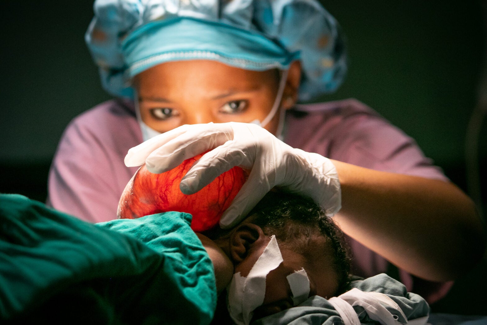 surgery in tanzania