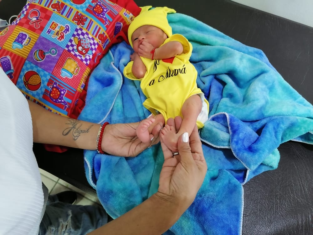 Baby Luis in Honduras received treatment for his clubfoot condition