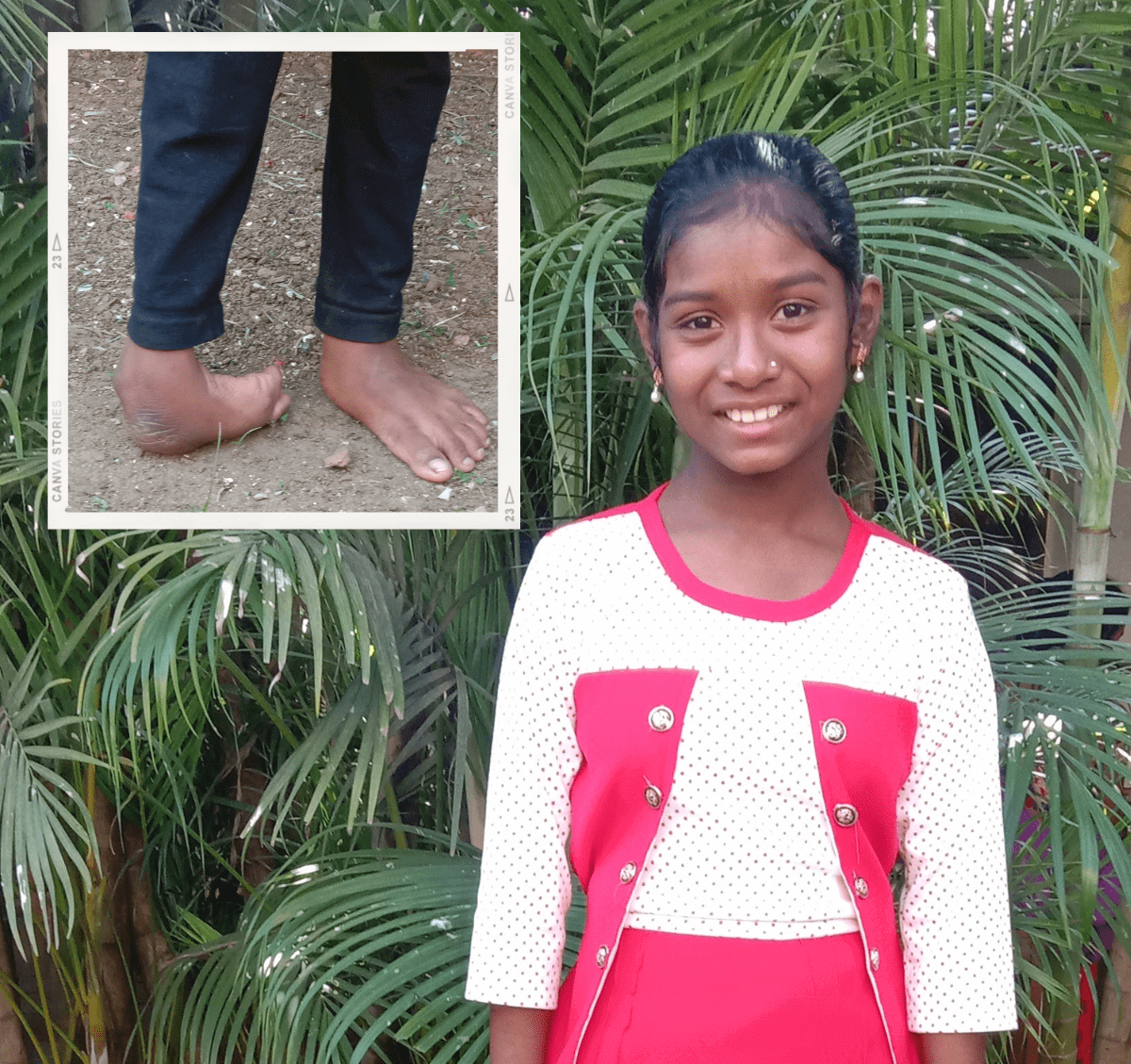 sonam-12-year-old-india-operation-blessing