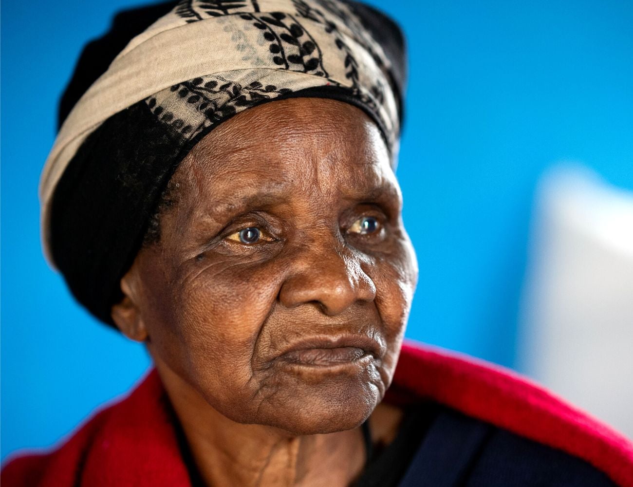 cataract surgery in South Africa