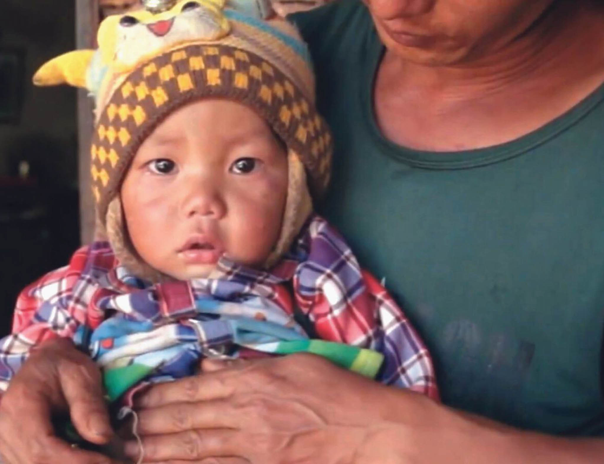 Baby Had One Day to Live