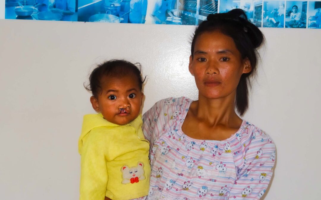Meet Srey Kouch: Cleft Lip Surgery