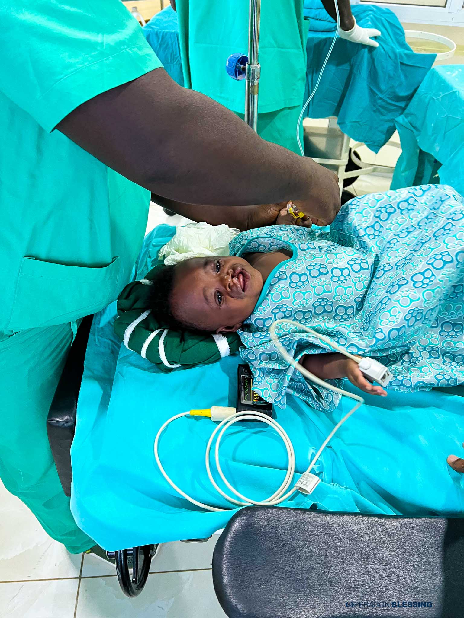 cleft lip surgery team