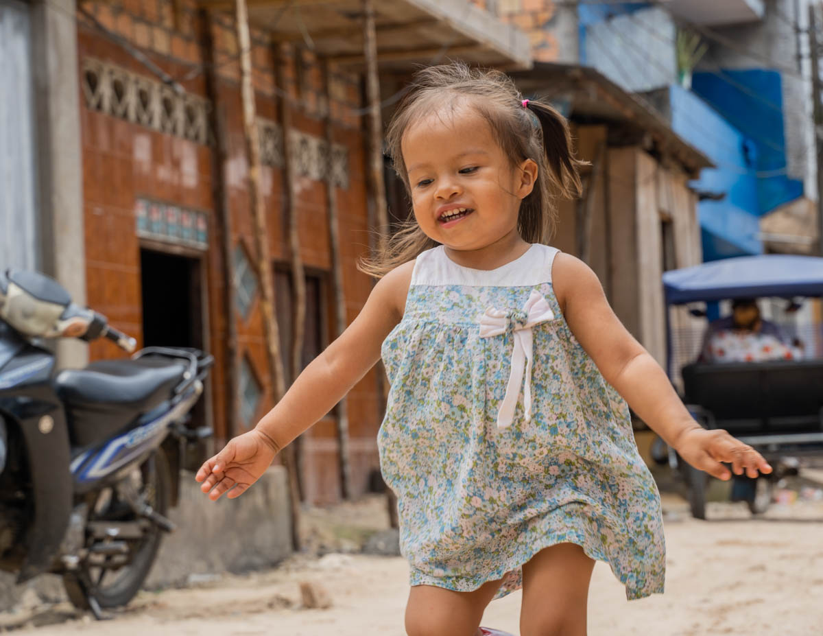 clubfoot-surgery-iquitos-peru