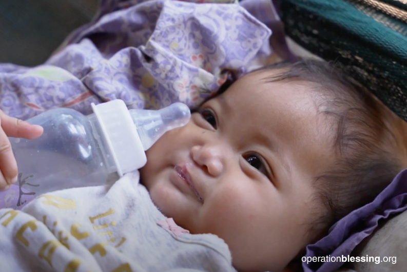 healed from cleft lip