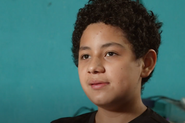 Nasal Tumors: A Silent Threat in the Life of a Child