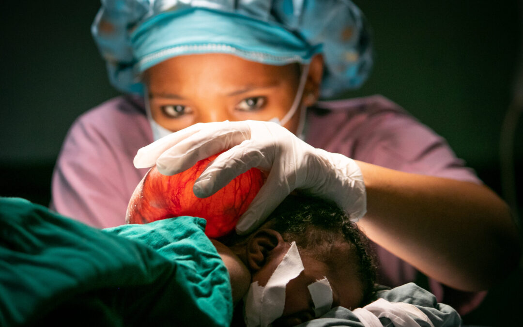 Saving a Child’s Life Through Surgery in Tanzania