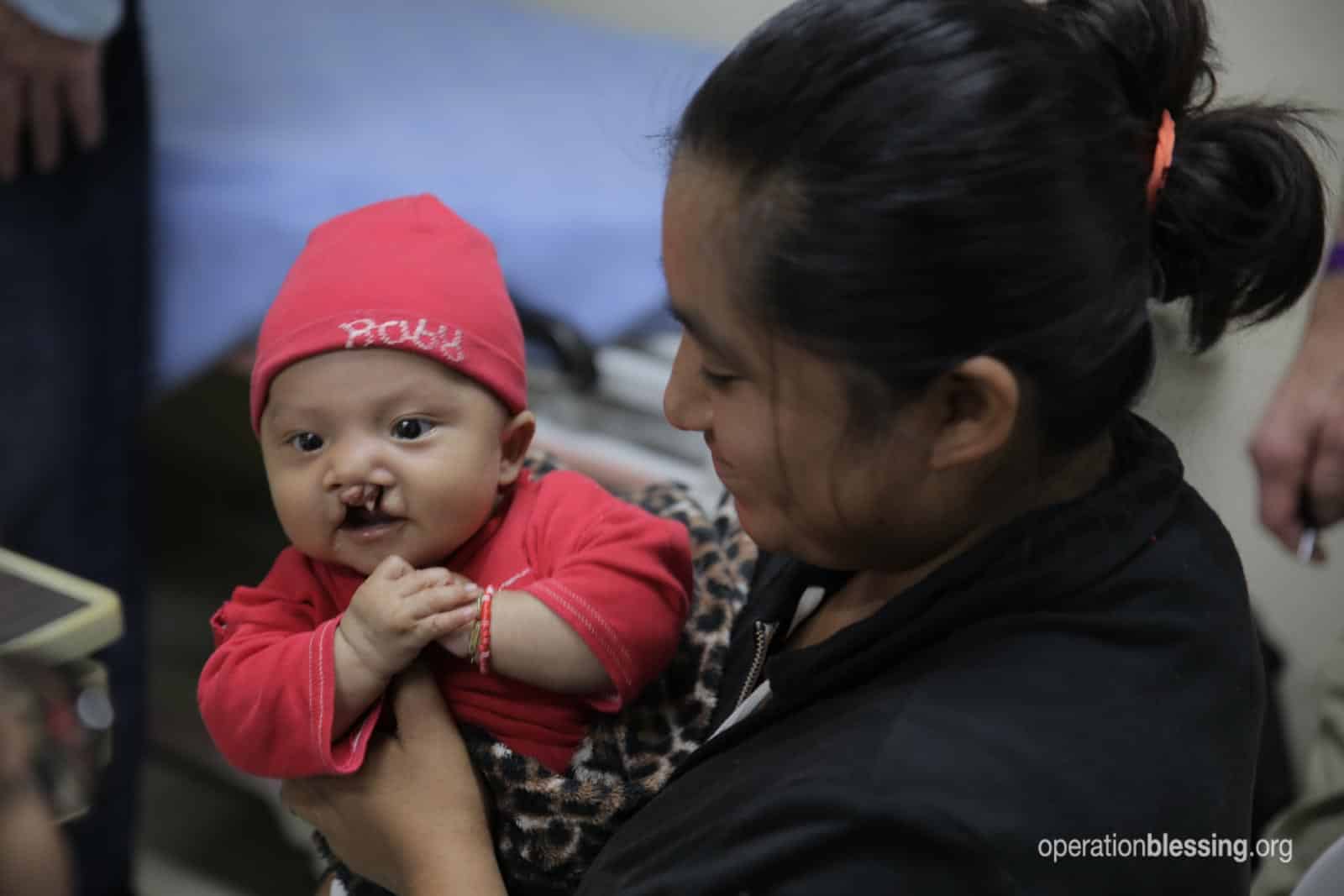 love-physical-form-cleft-lip