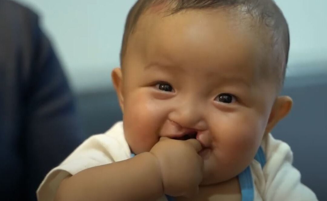 A New Smile for Dar in Cambodia!