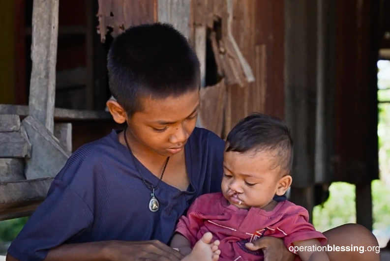 younger brother has cleft l