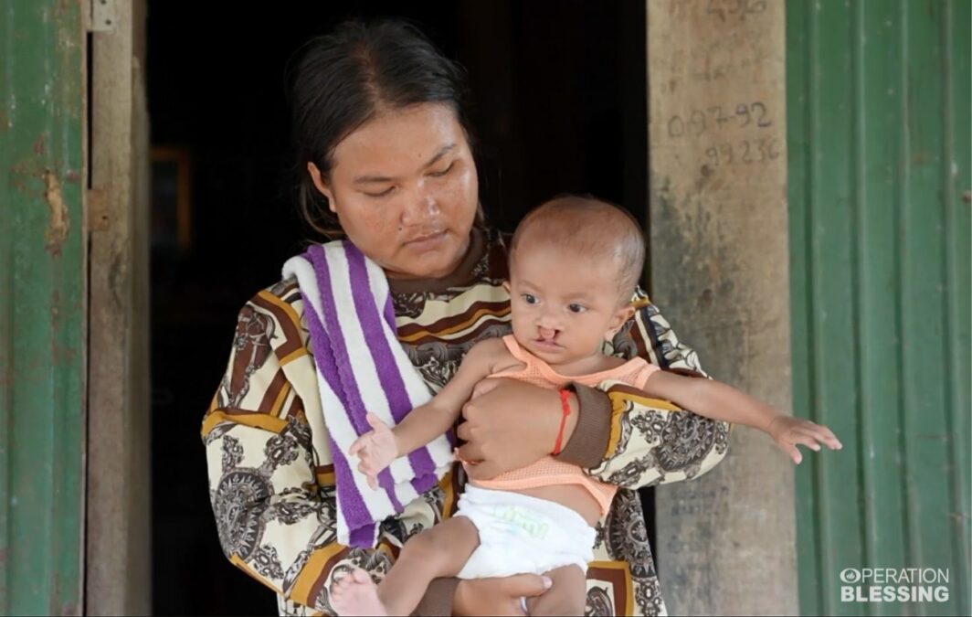 healing a baby of an oral cleft