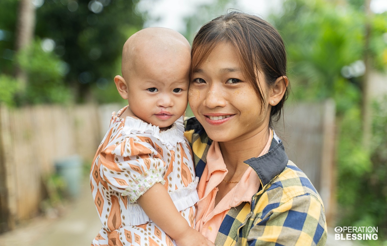 healed from cleft in Myanmar