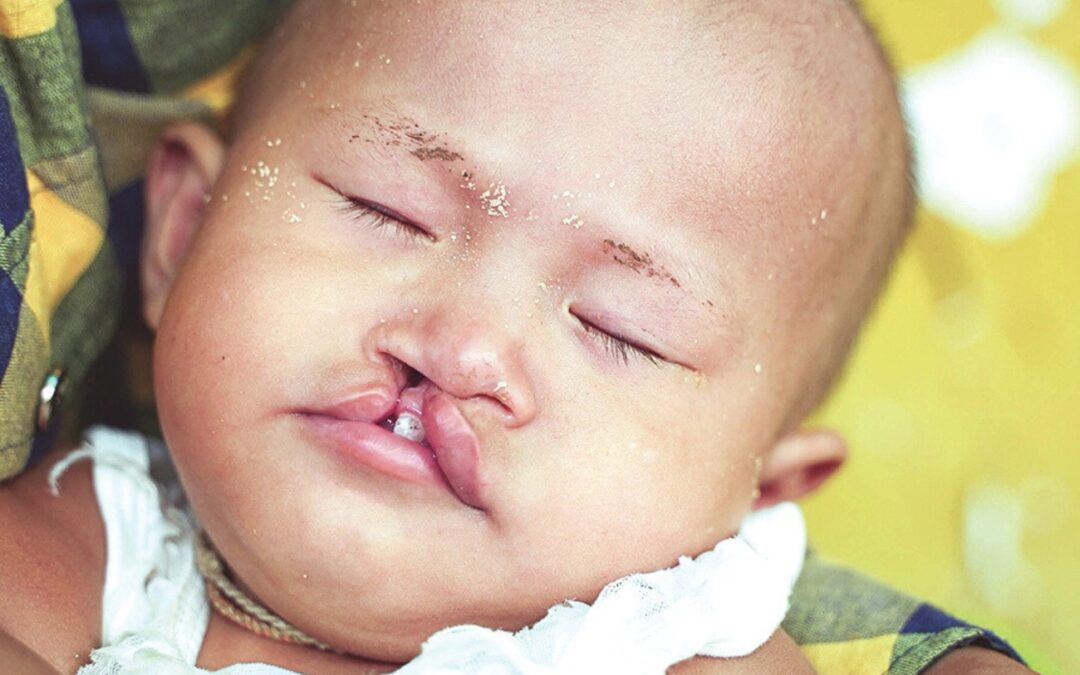 You Made Things New for a Sweet Little Girl in Myanmar