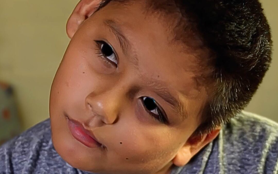 From Pain to Play: Kervis’s Life-Changing Torticollis Surgery