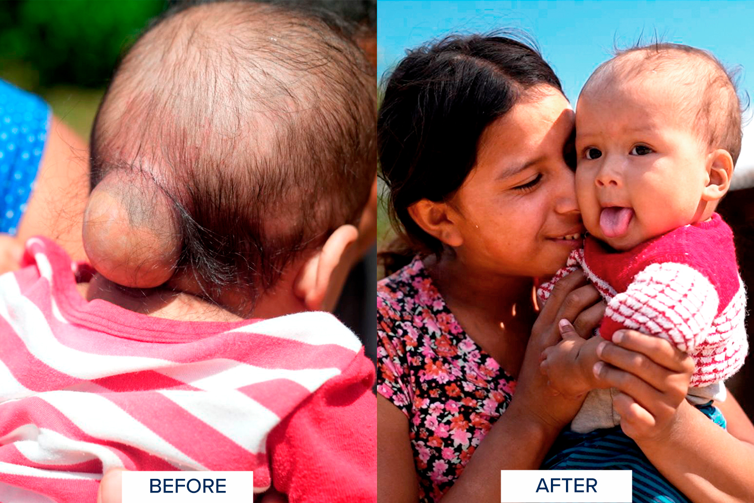 Life-changing surgeries 1