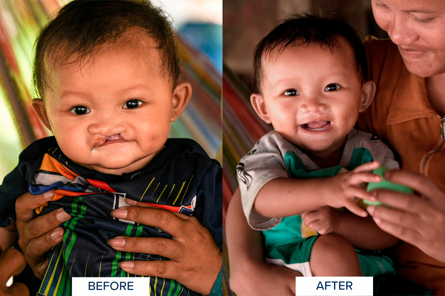 Life-changing surgeries 2