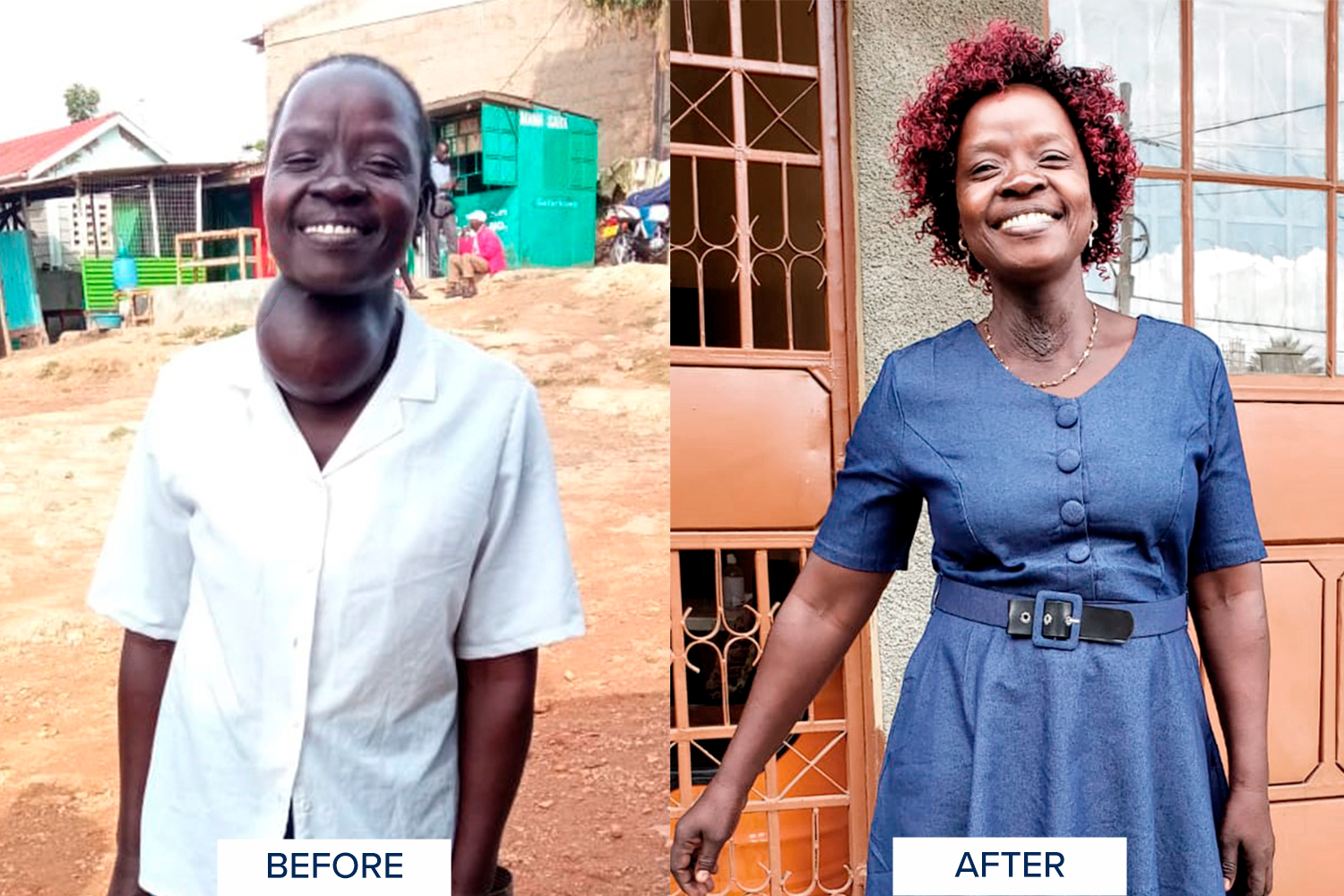 Life-changing surgeries 3