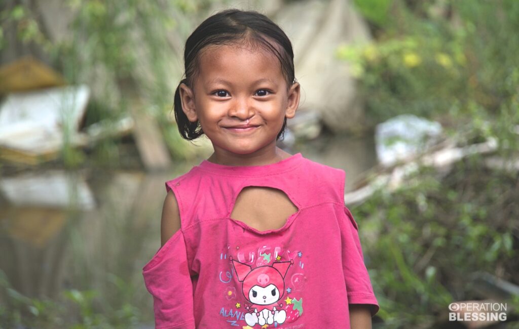 healed from cleft