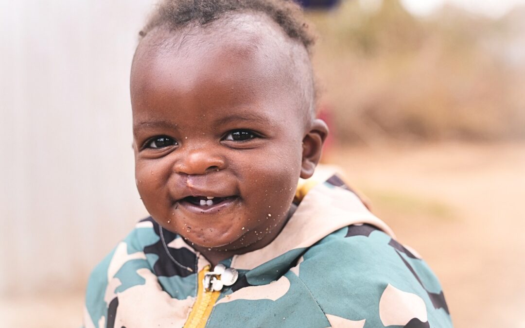 New Life, New Smile After Overcoming Cleft Lip