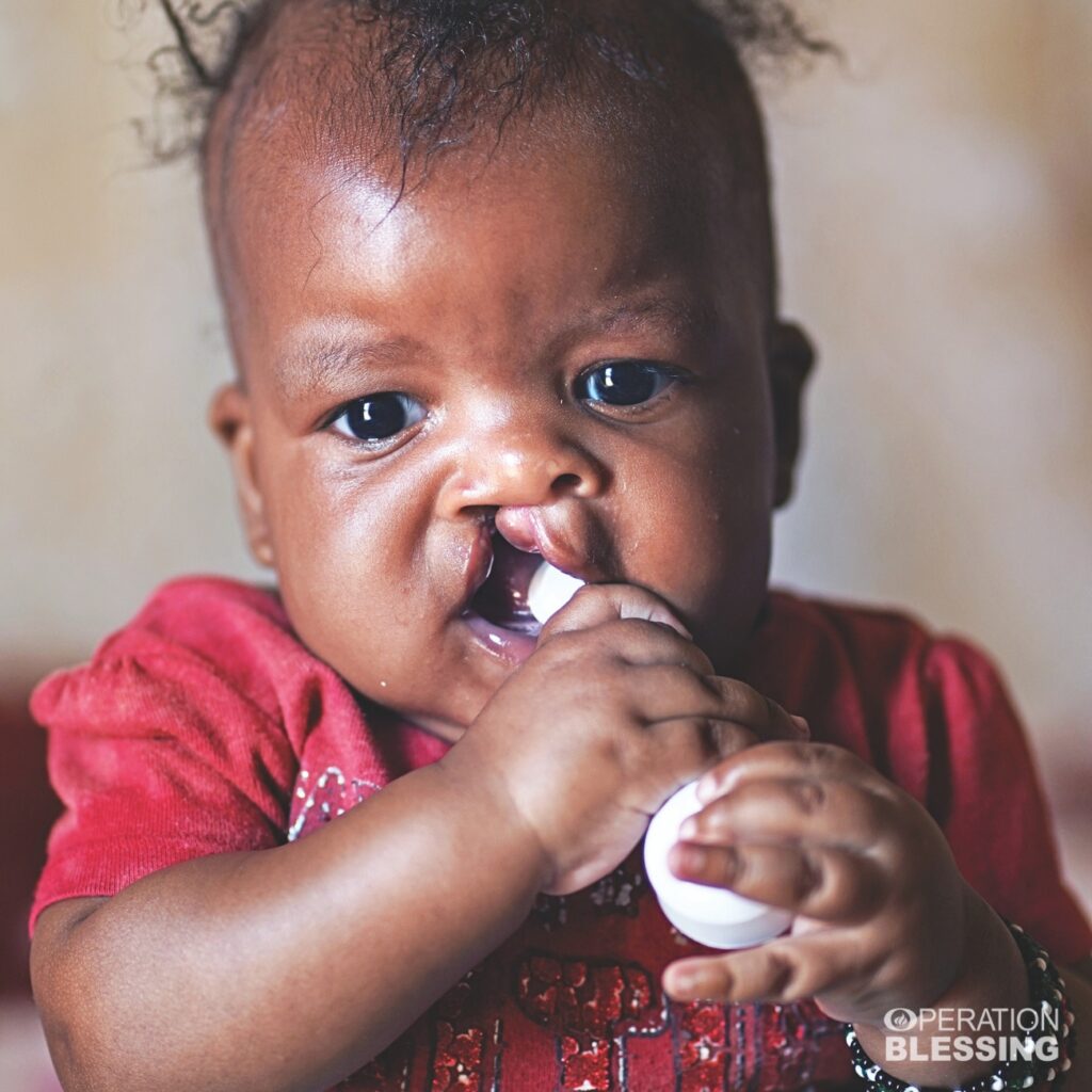 suffering with cleft